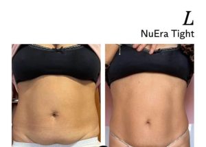 Sursă foto: Zinart Clinique.