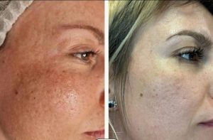 Sursă foto: Zinart Clinique.