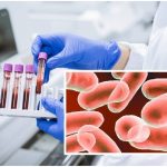 Maseuză la un salon SPA confirmată cu lepră! Alte 3 cazuri - în curs de evaluare! 12 page - Maseuză la un salon SPA confirmată cu lepră! Alte 3 cazuri - în curs de evaluare!