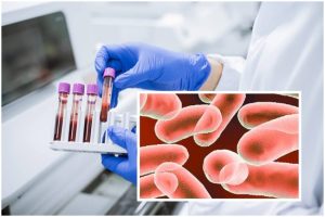 page - Maseuză la un salon SPA confirmată cu lepră! Alte 3 cazuri - în curs de evaluare!