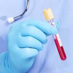 ANALIZE GRATUITE, în baza biletului de trimitere, la Spitalul Mioveni! 10 analize-medicale