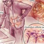 Clostridium la Curtea de Arges