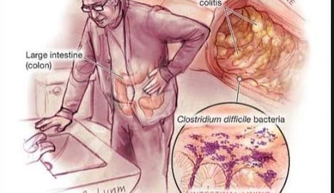 Clostridium la Curtea de Arges