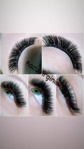 Îndreptare, regenerare și strălucire: avantajele nanoplastiei explicate de Virginia Racu 3 WhatsApp Image 2026 02 16 at 12.34.24 1 - Îndreptare, regenerare și strălucire: avantajele nanoplastiei explicate de Virginia Racu