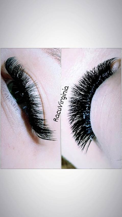 Îndreptare, regenerare și strălucire: avantajele nanoplastiei explicate de Virginia Racu 5 WhatsApp Image 2026 02 16 at 12.34.24 2 1 - Îndreptare, regenerare și strălucire: avantajele nanoplastiei explicate de Virginia Racu