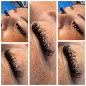 WhatsApp Image 2026 02 16 at 12.34.24 3 - Îndreptare, regenerare și strălucire: avantajele nanoplastiei explicate de Virginia Racu