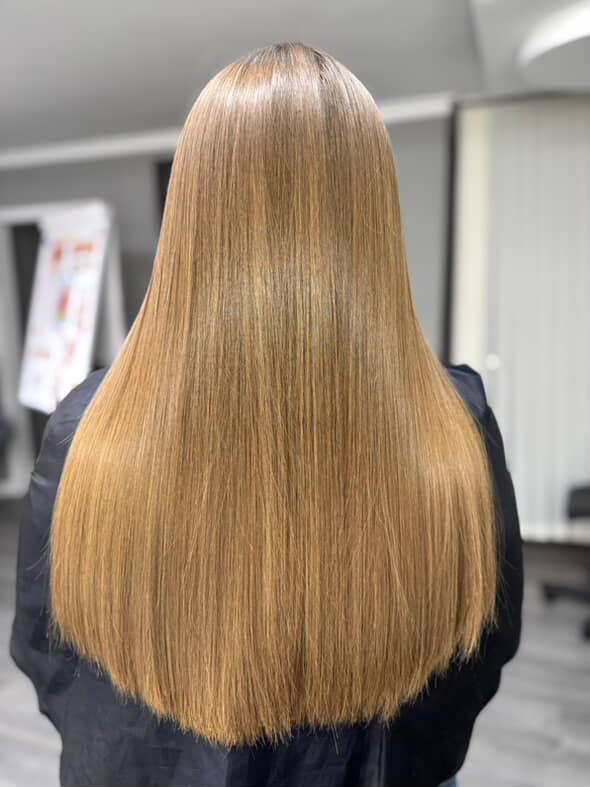 Îndreptare, regenerare și strălucire: avantajele nanoplastiei explicate de Virginia Racu 6 nanoplasti