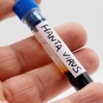 hantavirus