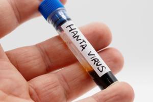 hantavirus