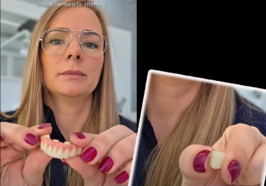 Sursă foto: screenshot video FB Clinica Dentara Dr eftimie