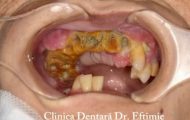dinti 1 Sursă foto: screenshot FB Clinica Dentară Dr. Eftimie.