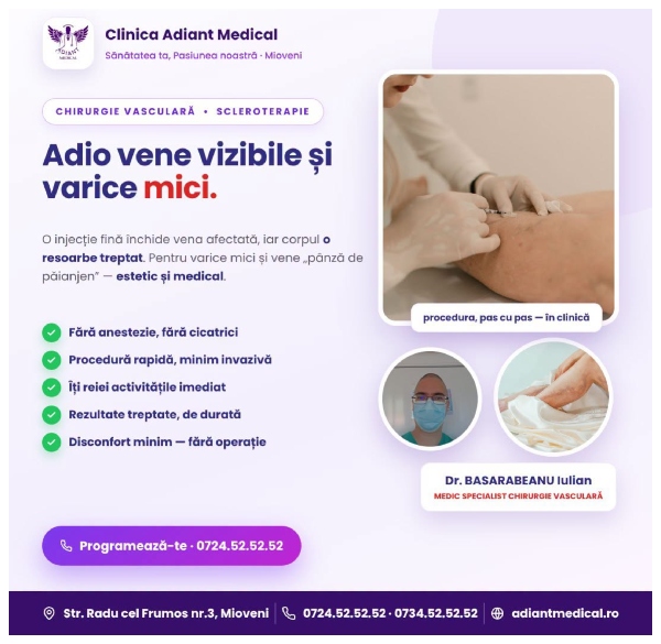 clinica adiant medical - Clinica Adiant Medical: soluții pentru varicele mici și venele „pânză de păianjen”