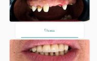 Sursă foto: FB Clinica Dentară Dr. Eftimie